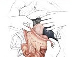 Chirurgie abdominale & gastroentrologie