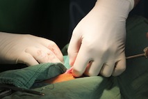 Chirurgie des tissus mous